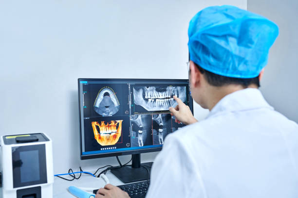 Best Emergency Wisdom Teeth Removal in Windy Hills, KY