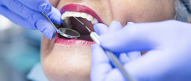 Best Emergency Root Canal Treatment in Windy Hills, KY